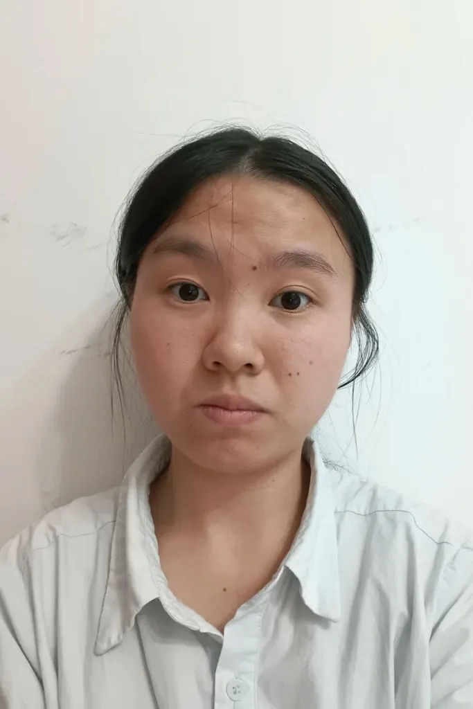 Ảnh gái xấu có cái đầu to và đôi mắt lệch