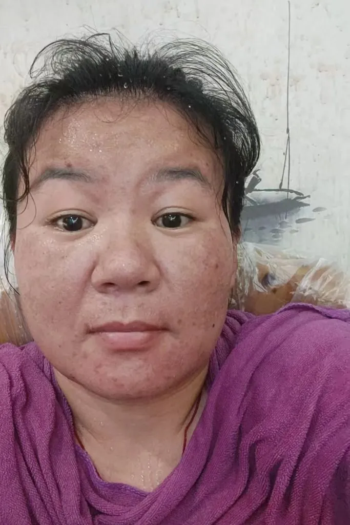 Ảnh gái xấu do di truyền